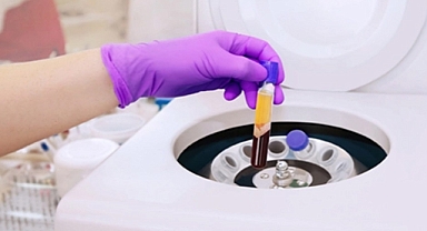 PRP Tedavisi: Doğal İyileşmenin Bilimsel Gücü