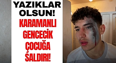 Karaman'ın Çocuklarına Saldırdılar: 