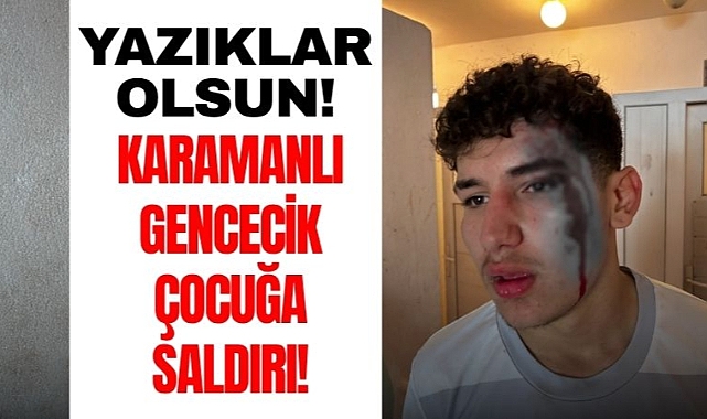 Karaman'ın Çocuklarına Saldırdılar: 